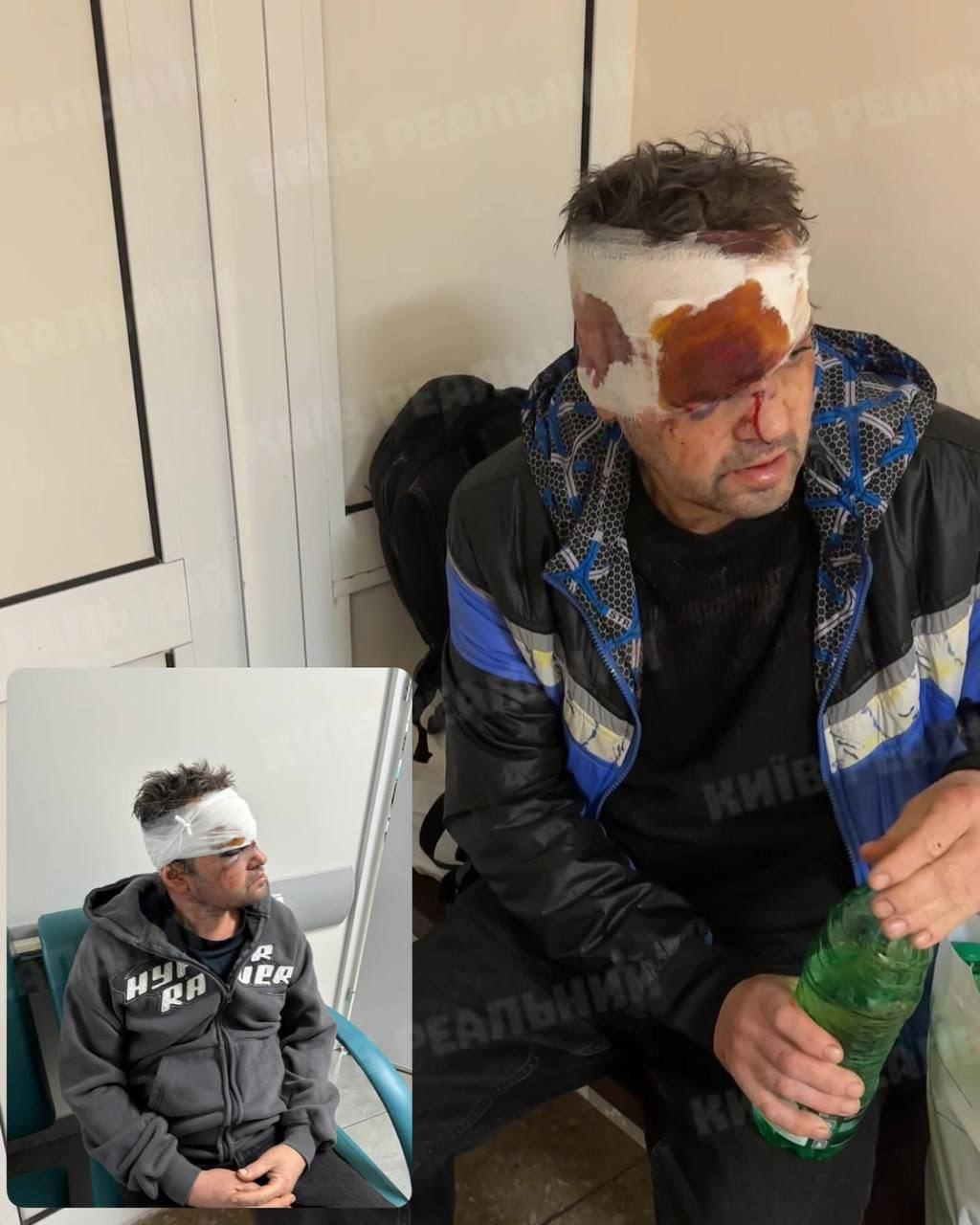У Києві мобілізованого звинуватили у неправдивих заявах про побиття на збірному пункті