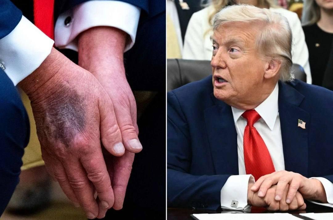 Соцмережі обговорюють чутки про смерть Трампа