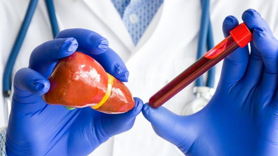 Таємний шифр печінки: як розпізнати стан здоров’я за аналізами