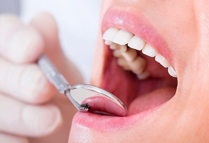 Керамічні реставрації: огляд можливостей сучасної естетичної стоматології