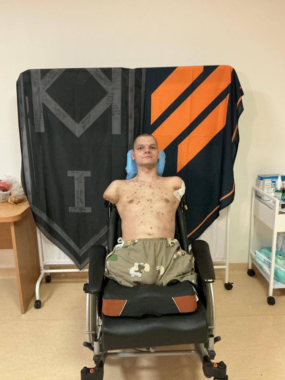 «ПриватБанк» заявив про готовність оплатити лікування й протезування ветерану після скандалу з відмовою у видачі картки