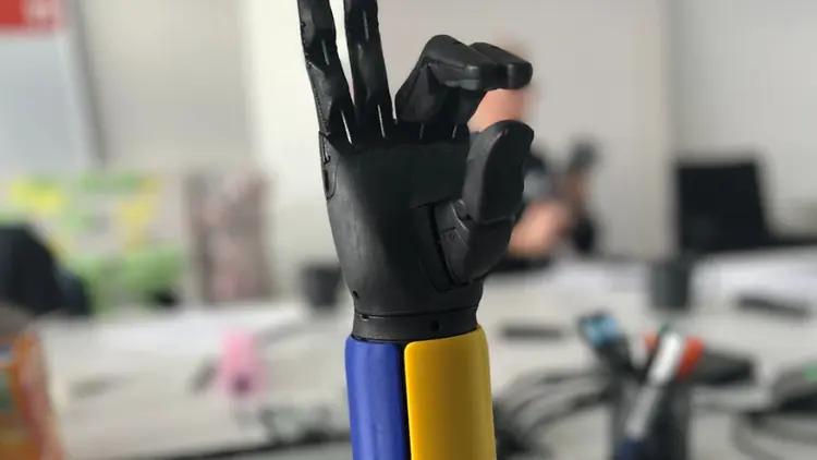 У Полтаві створили другу в Україні мікроклініку протезування. Третя буде на Київщині