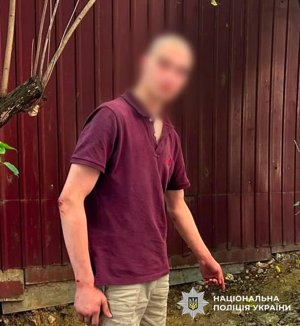 Хотів вразити дівчат: у Голосієві хлопець запустив сигнальні ракети у дворі багатоповерхівки