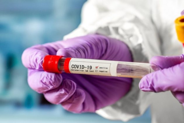 В Україні за добу 354 нових випадки коронавірусу і 16 смертей