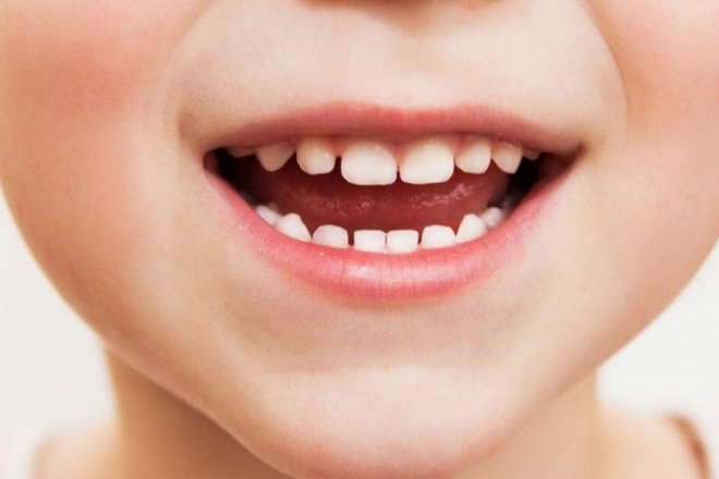 Щоб зубки не хворіли: як підготувати дитину до візиту в стоматологію