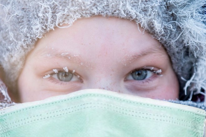 Взимку шкіра лущиться і тріскається: як доглядати за обличчям і руками під час холодів