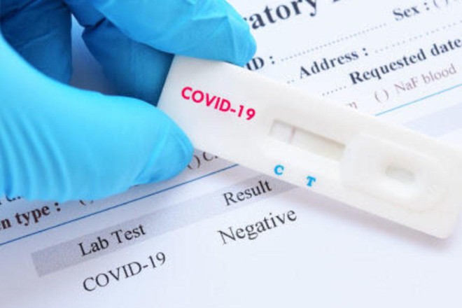 69 лікарень отримали експрес-тести на COVID-19 – СПИСОК