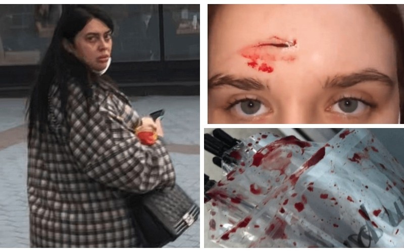 Жінка до крові побила дівчину парасолькою в ТРЦ Ocean Plaza (ФОТО, ВІДЕО)