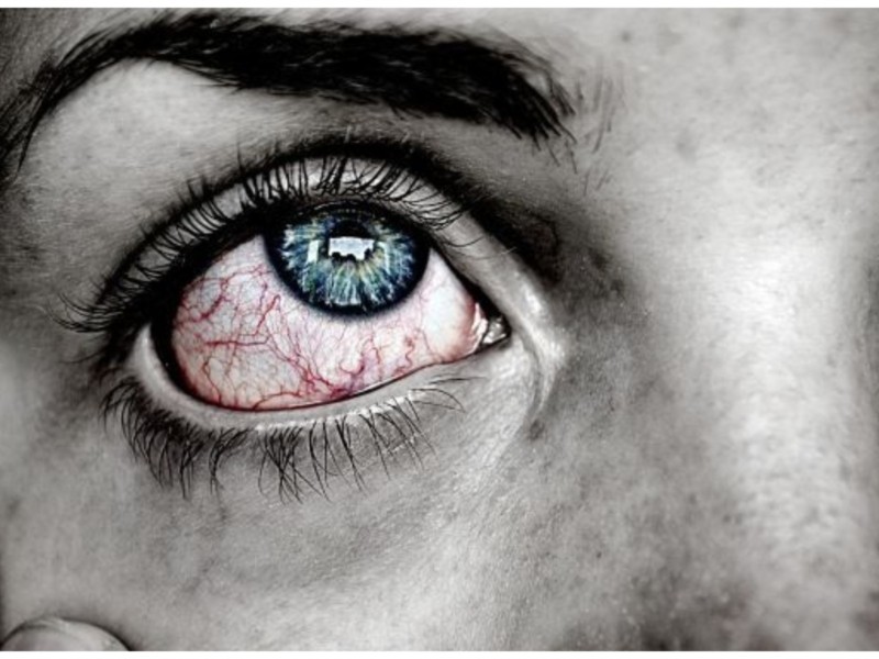 Головний біль, нудота, налиті кров’ю очі: що варто знати про симптоми Омікрону