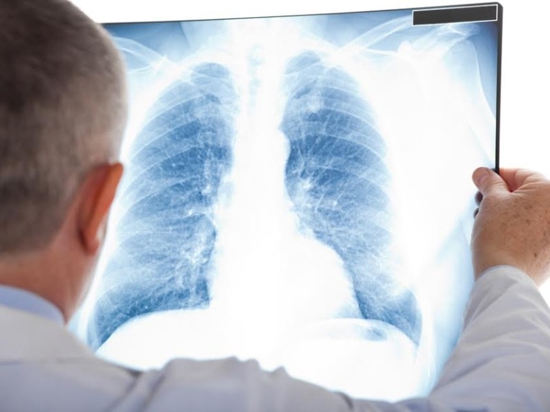 У лікарнях передмістя з’явилися 10 сучасних рентген апаратів