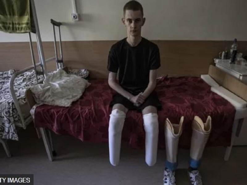 «Няньки в мене не буде»: військовий, що втратив ноги під Бородянкою