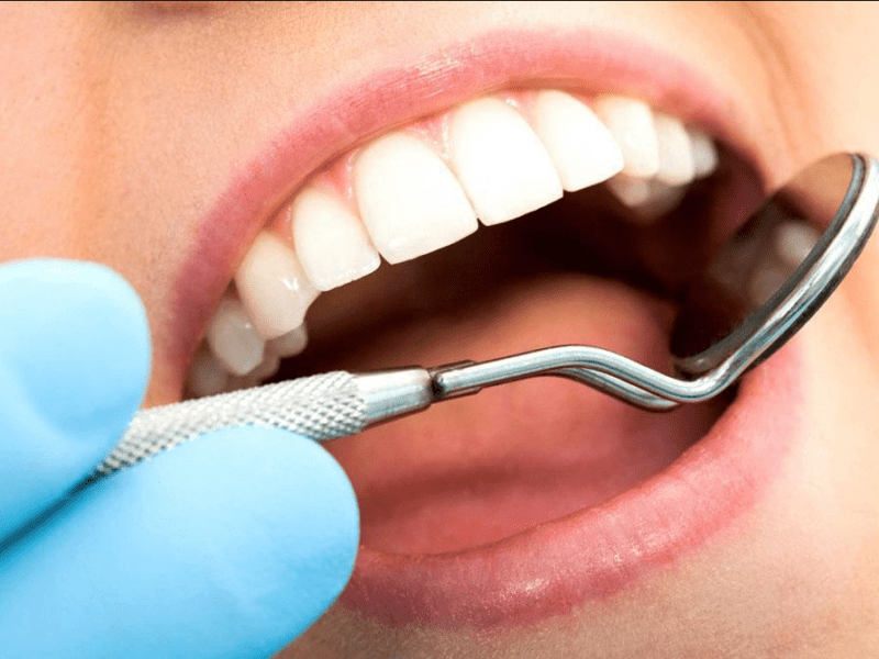 Як часто потрібно відвідувати стоматолога і в чому полягає така необхідність