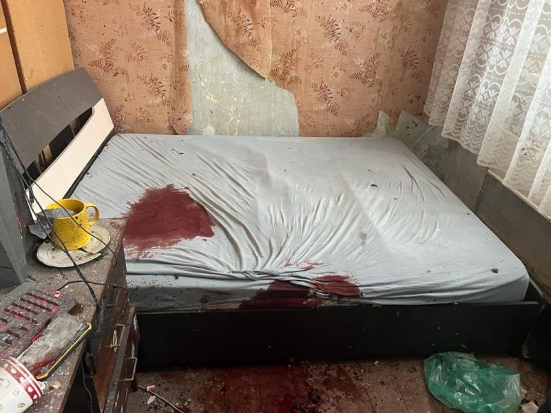 Потрощило руку і рознесло кімнату: на Київщині від вибуху гранати постраждав 21-річний хлопець