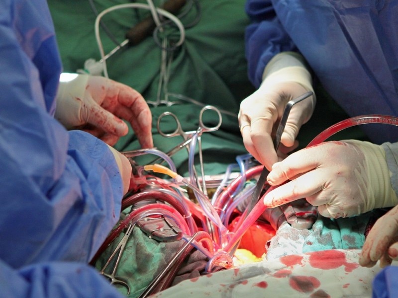 Болі, що не давали жити: в Інституті Шалімова провели унікальну операцію одночасно на судинах серця, шиї і ноги