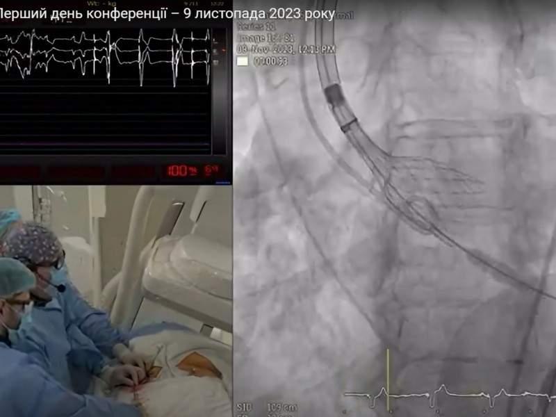 Вперше в Україні була проведена жива онлайн-трансляція з імплантації аортального клапана серця