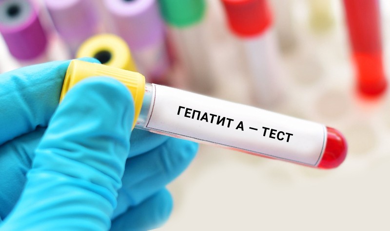 На Київщині зафіксовано випадок захворювання на вірусний гепатит А
