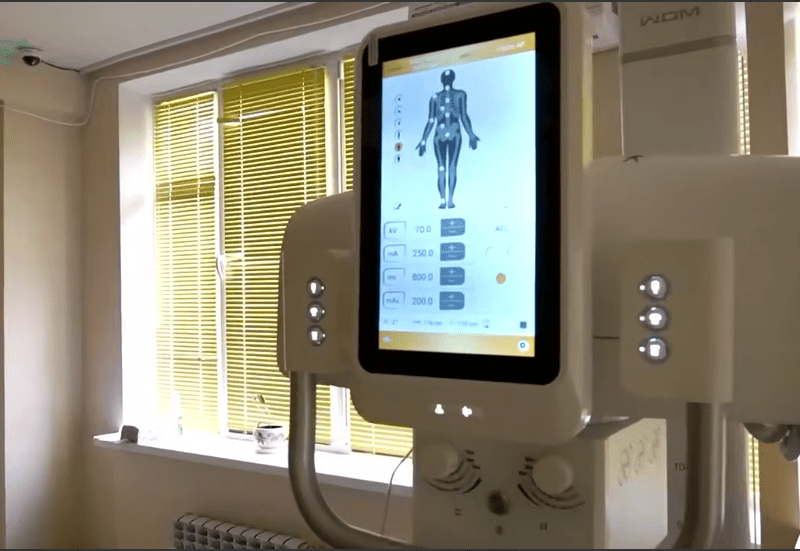 Лікарня в Ірпені розжилась сучасним рентген-апаратом: опромінює менше, а знімки – чіткіші