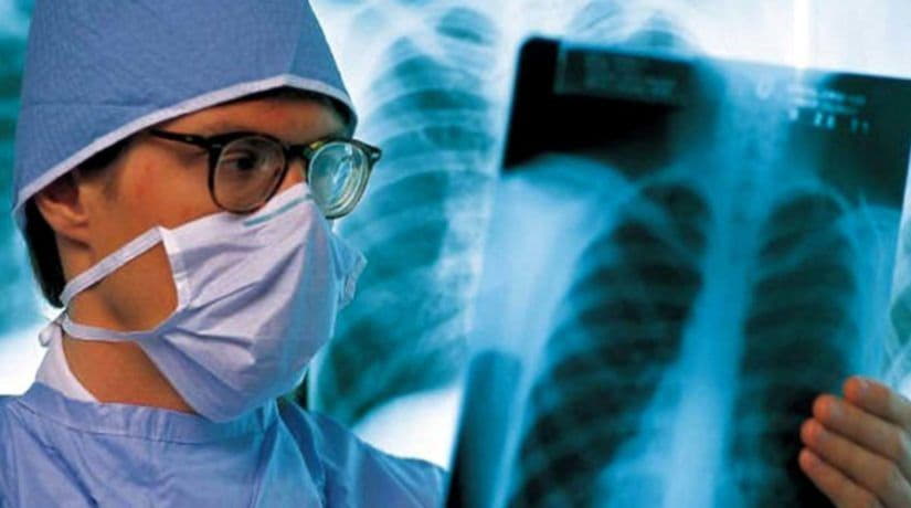 Украина занимает второе место в Европе по заболеваемости туберкулезом
