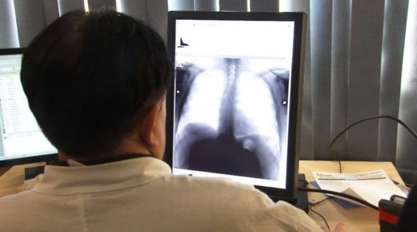 Город закупит цифровой рентген для диагностики туберкулеза